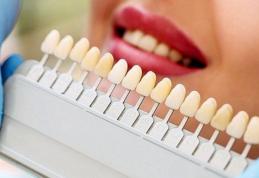 Patru modalități naturale pentru albirea dinților