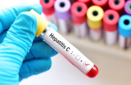 Start la testarea pentru hepatite în județele Botoșani și Buzău