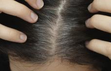 Cauze ale albirii părului de care nu știai