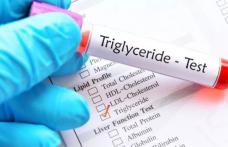 Aflați cum puteți reduce trigliceridele în mod natural