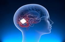 Mii de oameni doresc să li se implanteze un cip în creier într-un program experimental dezvoltat de compania lui Elon Musk