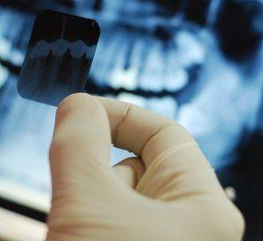 Cât de periculoase sunt radiografiile dentare