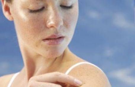 Medic: „Cancerul de piele este o boală care se poate dobândi la locul de muncă”