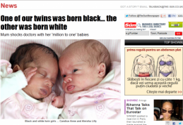 INCREDIBIL: Două gemene s-au născut una albă şi cealaltă neagră 