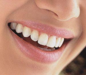 Opt remedii naturale pentru albirea naturală a dinţilor