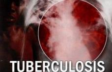 Lupta globală împotriva tuberculozei 