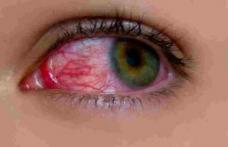 Boli care pot fi „citite” în aspectul ochilor