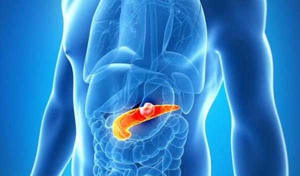cancer de pancreas