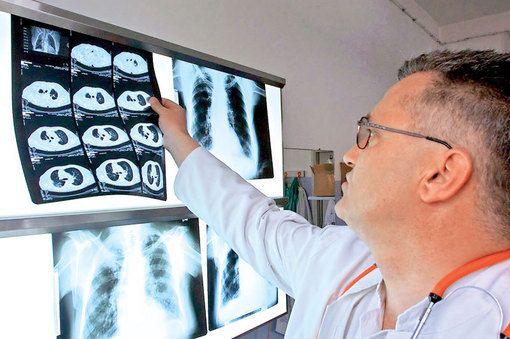 radiografii