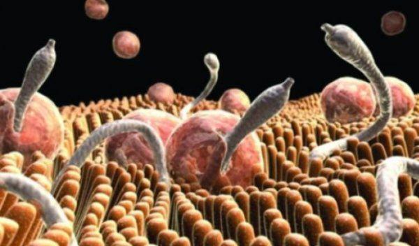 paraziti_intestine