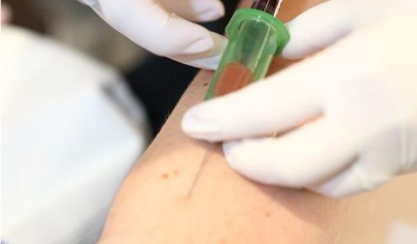 testare hepatita c - 2