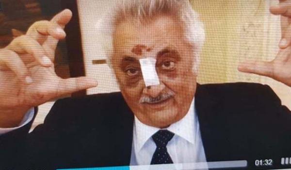 bacalbasa-cu-nasul-rupt