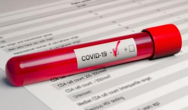 Coronavirus_d