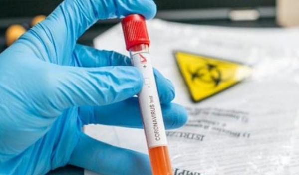 Coronavirus-test-pozitiv