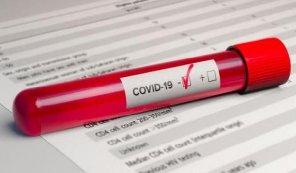 coronavirus