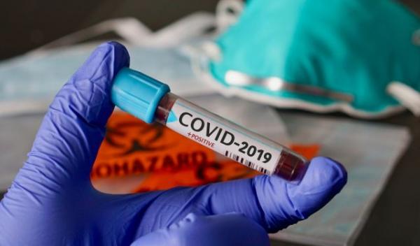 Coronavirus-COVID-19