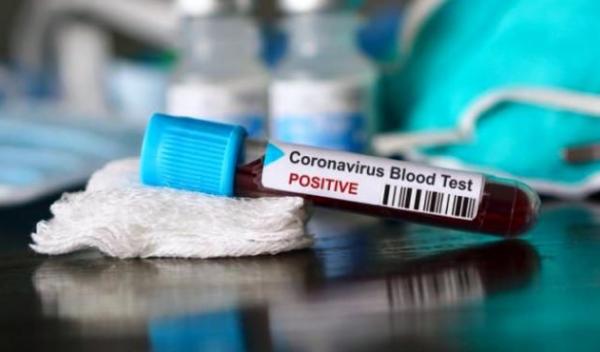 covid-test-deces