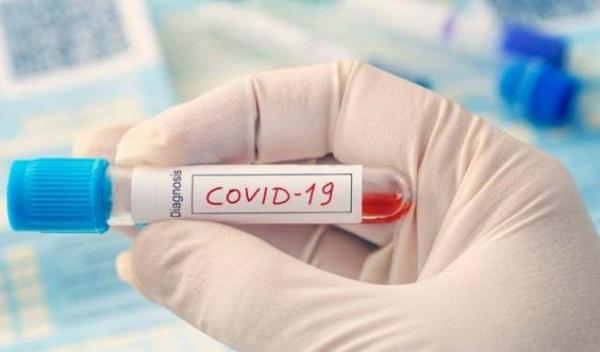 coronavirustest