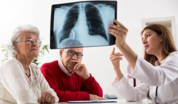 cancer-pulmonar-femei