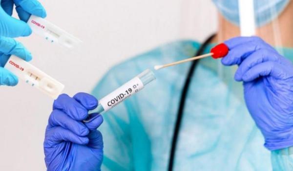 Test antigen