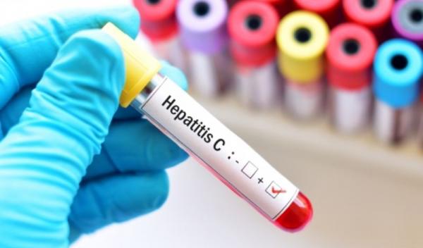 Hepatita C