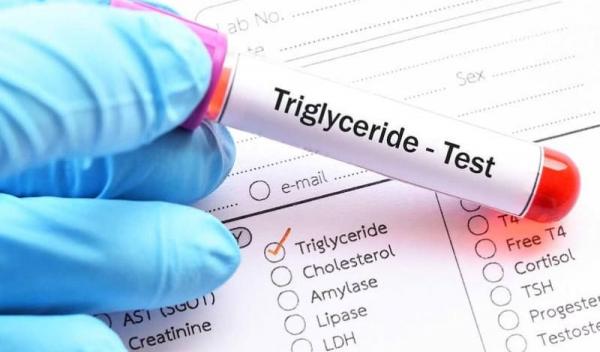trigliceride