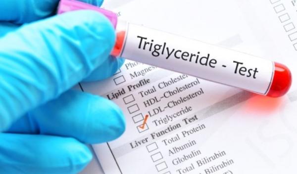 trigliceride