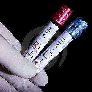 hiv