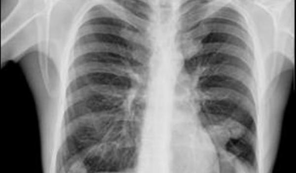 radiografie