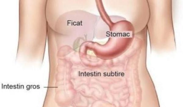 Cancerul de stomac
