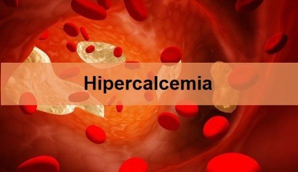 hipercalcemia