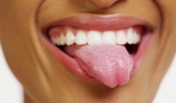 limba-crapata-simptome