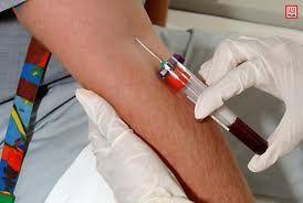 probe biologice sange